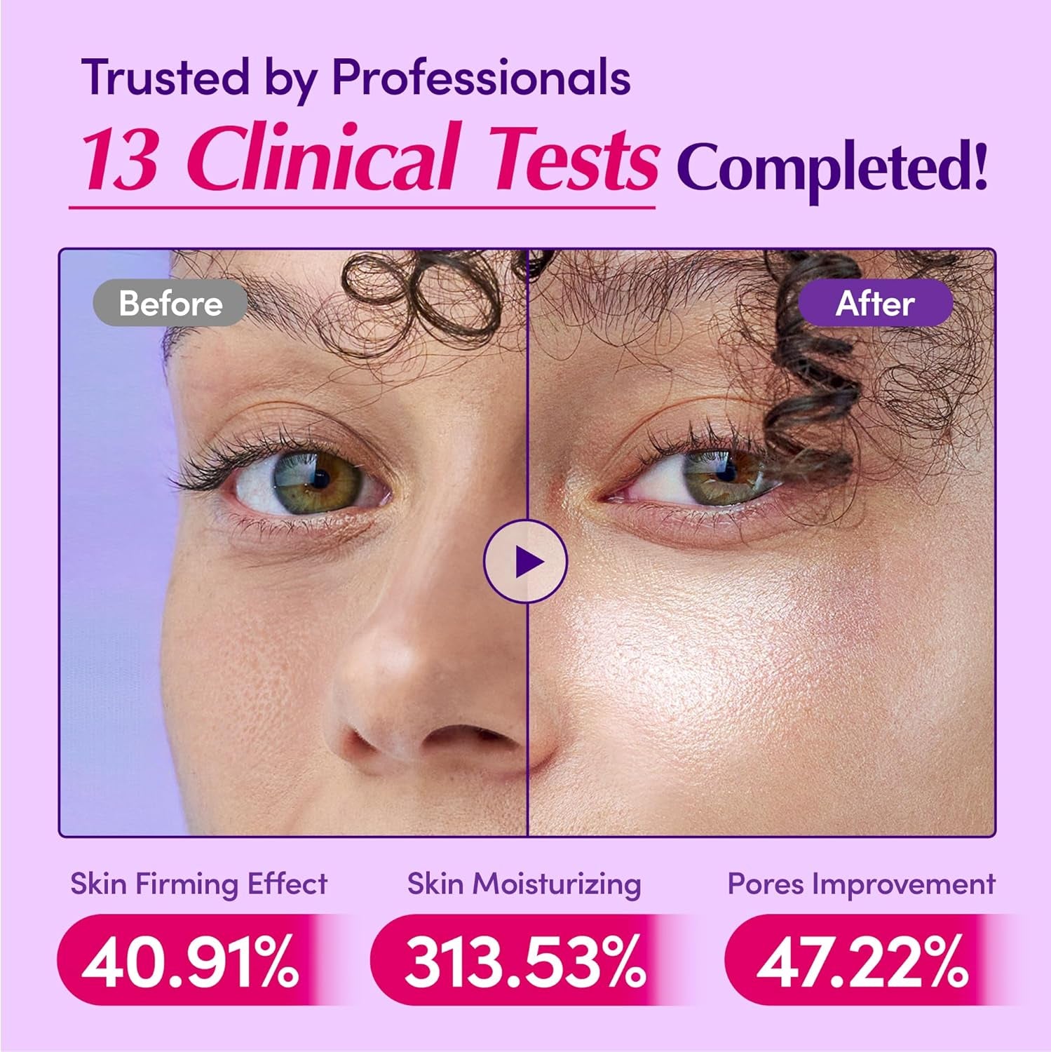 Bakuchiol Plumping Face Serum - Retinol Natural Alternative for Sensitive Skin, with Niacinamide & Hyaluronic Acid, Pore & Wrinkle Korean Skin Care (1.01Oz / 30Ml)